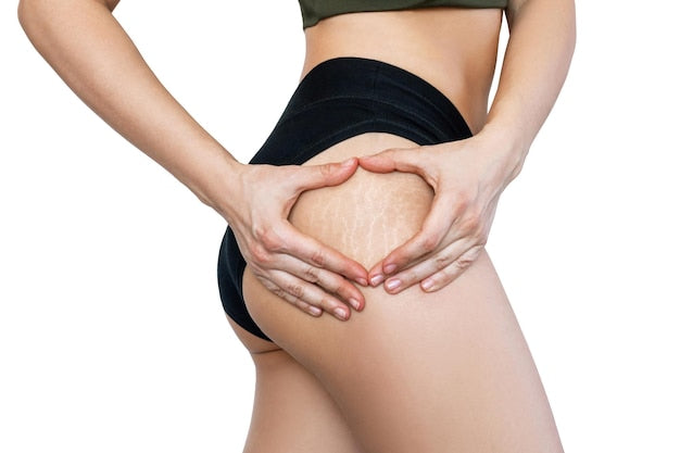 Dr. James 7 Days Slimming Anti-Cellulite Gel USA