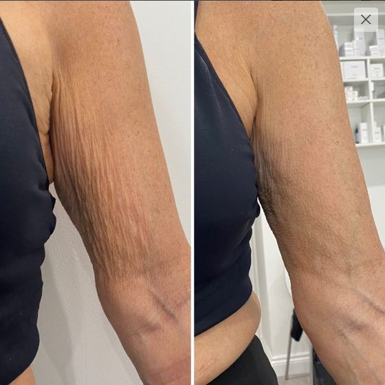 Dr. James 7 Days Slimming Anti-Cellulite Gel USA