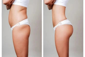 Hip Cream – Increase & Tighting